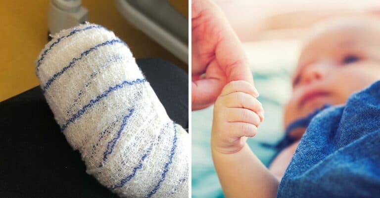 "Un cheveu nous semble inoffensif" : cette maman alerte sur le syndrome du tourniquet